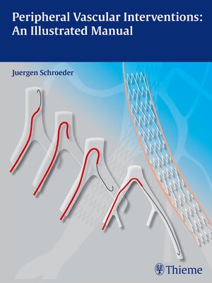 cover image of Peripheral Vascular Interventions